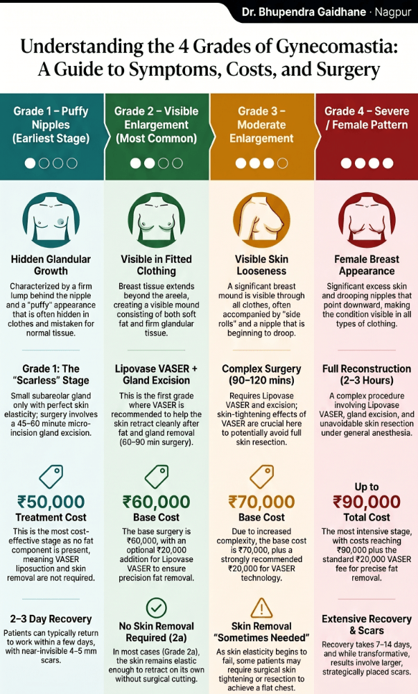 Infographic showing progression of gynecomastia from Grade 1 to Grade 4, highlighting increasing severity, need for skin removal, longer recovery, and more complex surgical management