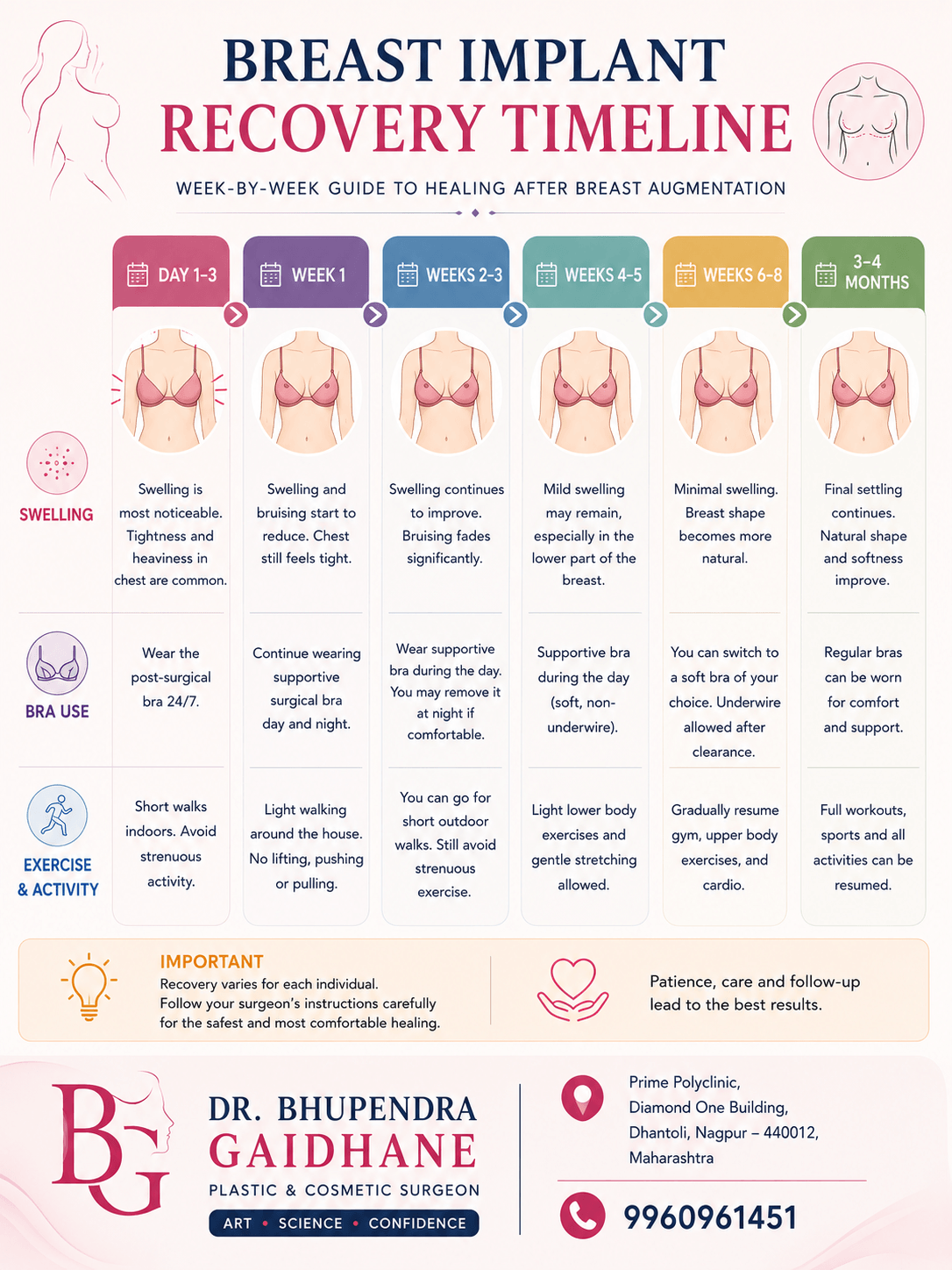 Breast implant recovery timeline week by week after breast augmentation surgery in Nagpur