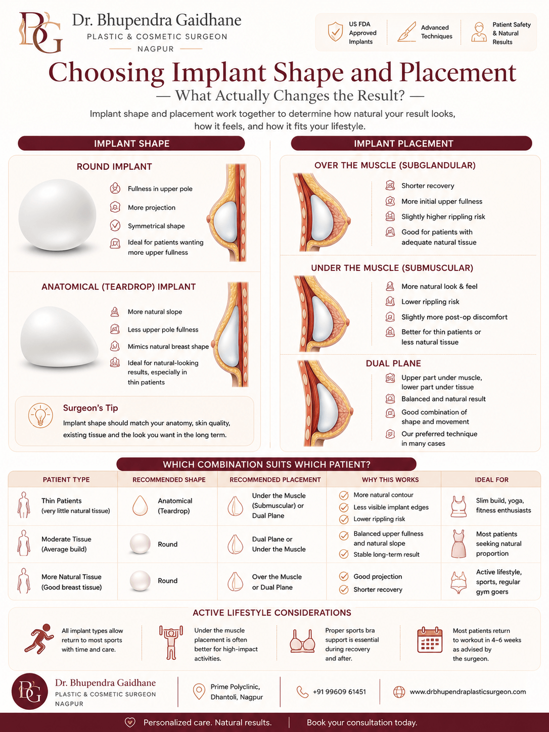 Breast implant shape and placement infographic showing round vs anatomical implants and over muscle vs under muscle vs dual plane placement options.