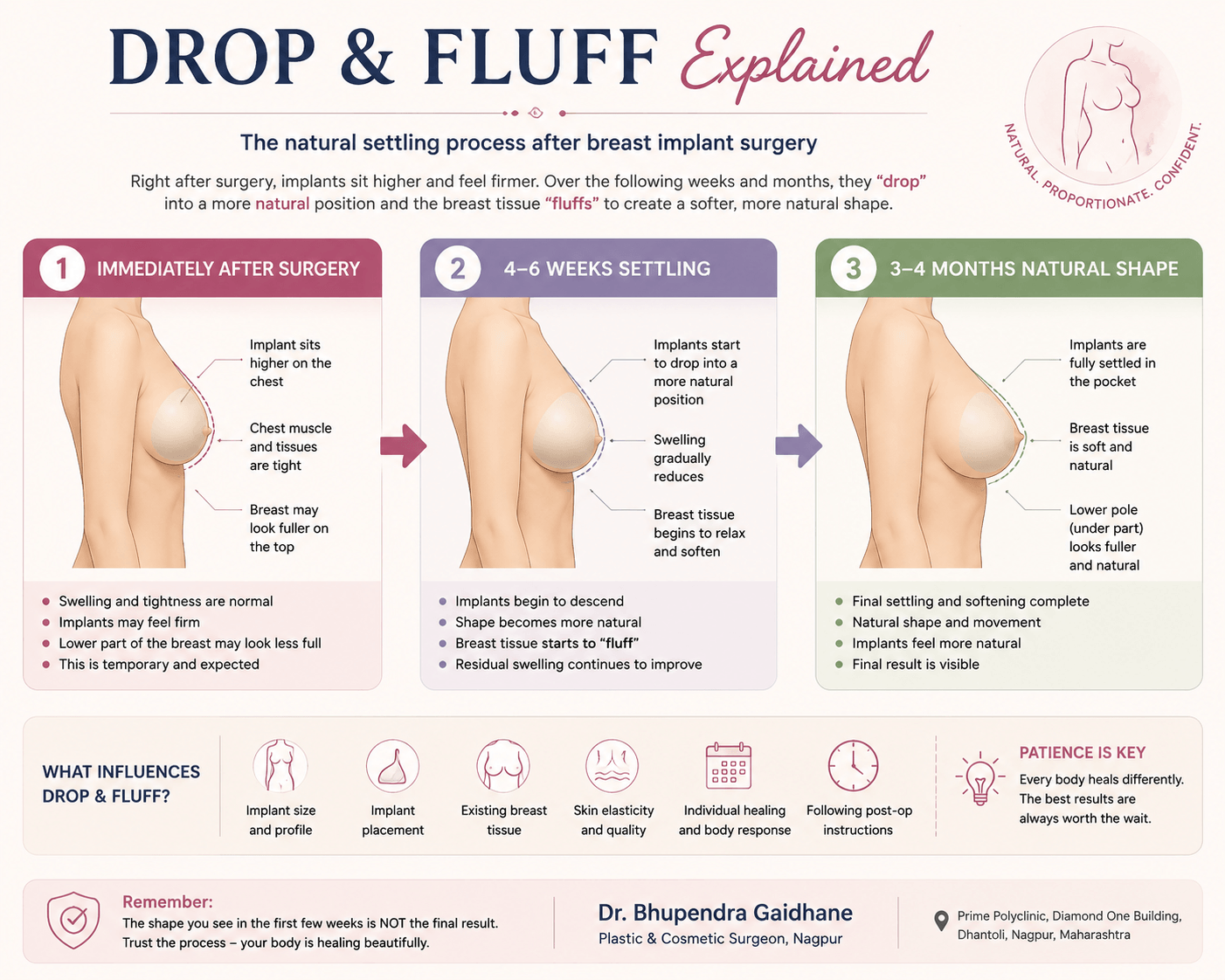 Drop and fluff process after breast implant surgery explained visually