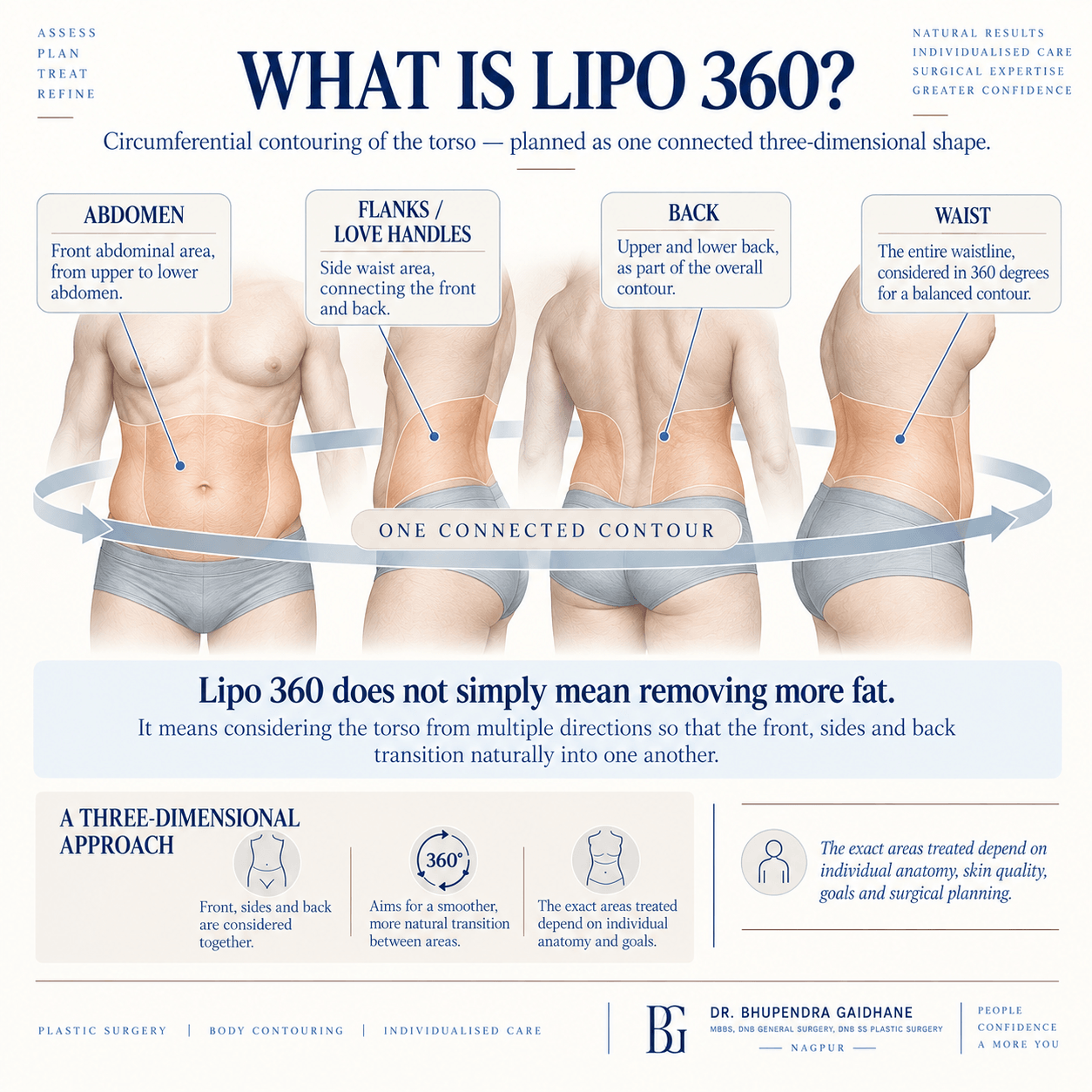 What Is Lipo 360? — Three-Dimensional Body Contouring Lipo 360 infographic showing abdomen, flanks, waist and back as connected torso contouring areas